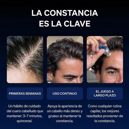 Luren NovaHair™ Kit Microinfusión con Sérum | Crecimiento real desde la raíz