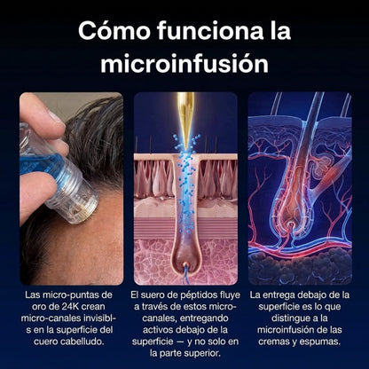 Luren NovaHair™ Kit Microinfusión con Sérum | Crecimiento real desde la raíz